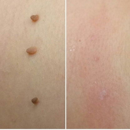 DERMALYA™ | Retrouvez une peau lisse en 4 jours