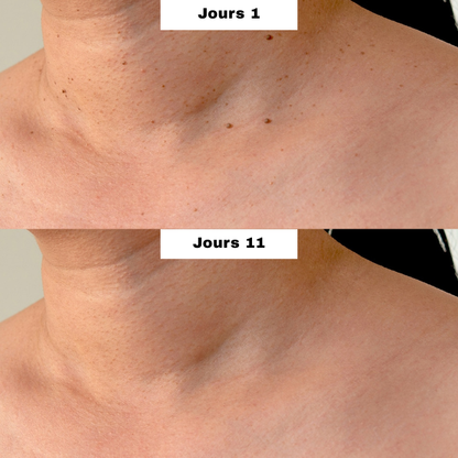 DERMALYA™ | Retrouvez une peau lisse en 4 jours