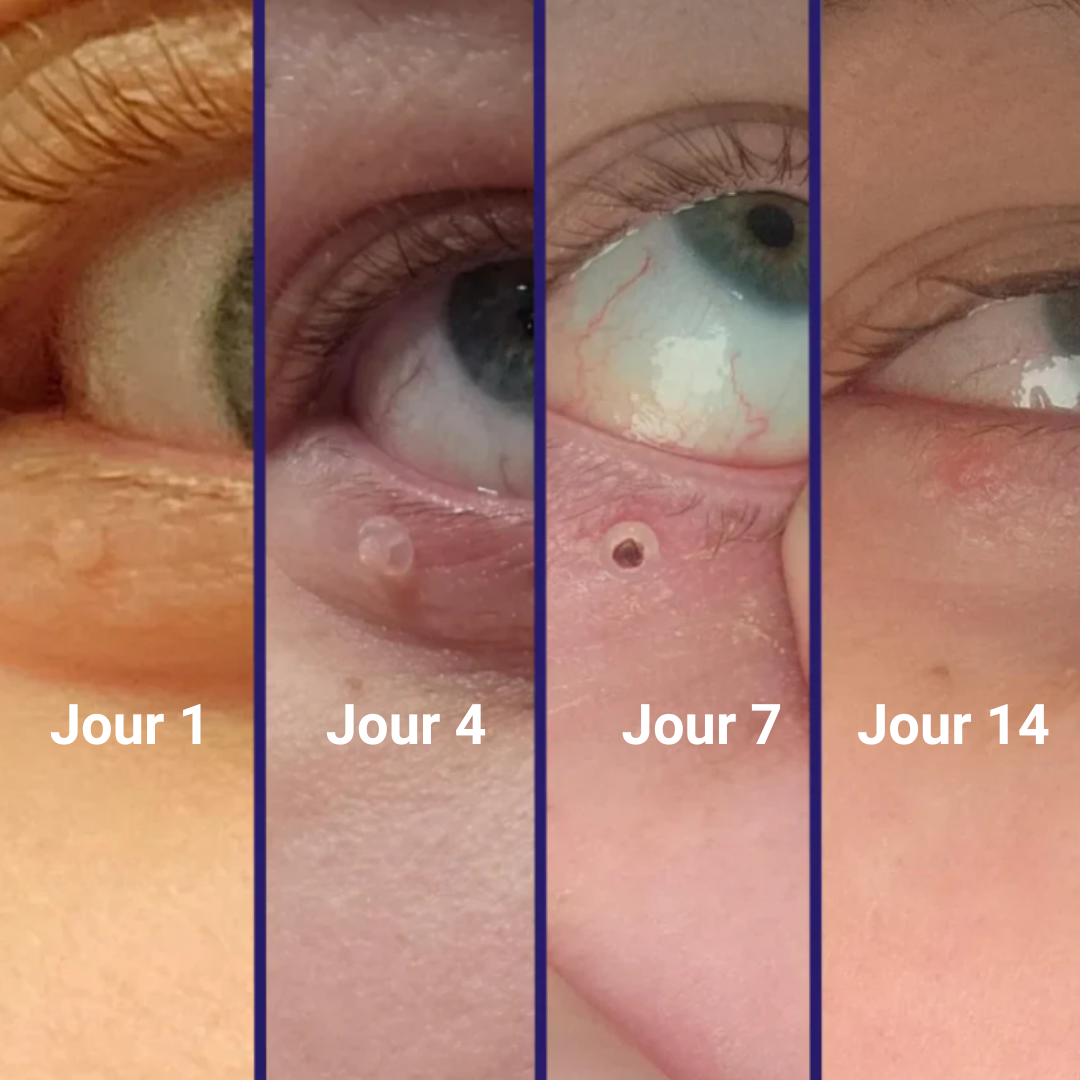 DERMALYA™ | Retrouvez une peau lisse en 4 jours