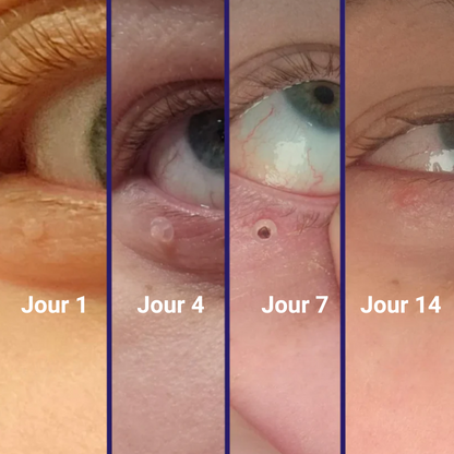 DERMALYA™ | Retrouvez une peau lisse en 4 jours